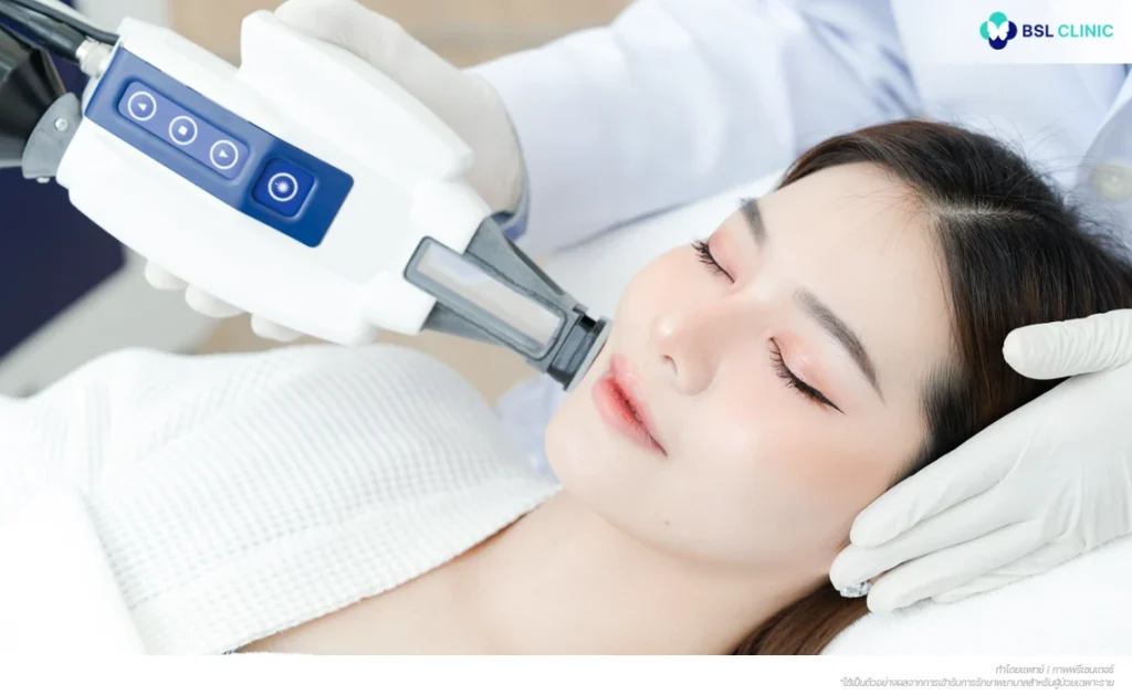 accure -laser