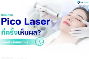 Pico Laser กี่ครั้งเห็นผล Pico Laser Sessions