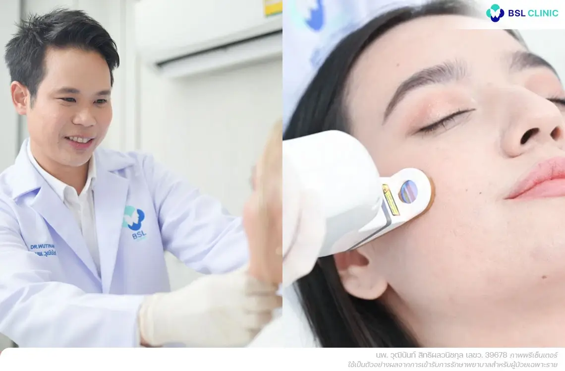 bsl-clinic-acne-treatment รักษาสิว BSL