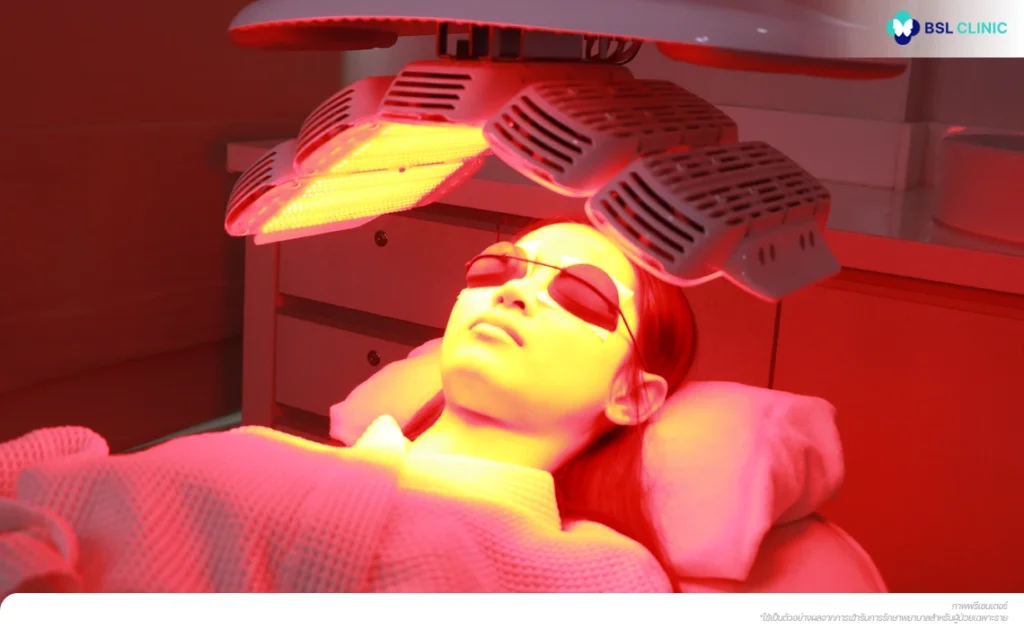 light-therapy-acne-reduction ฉายแสงลดสิว