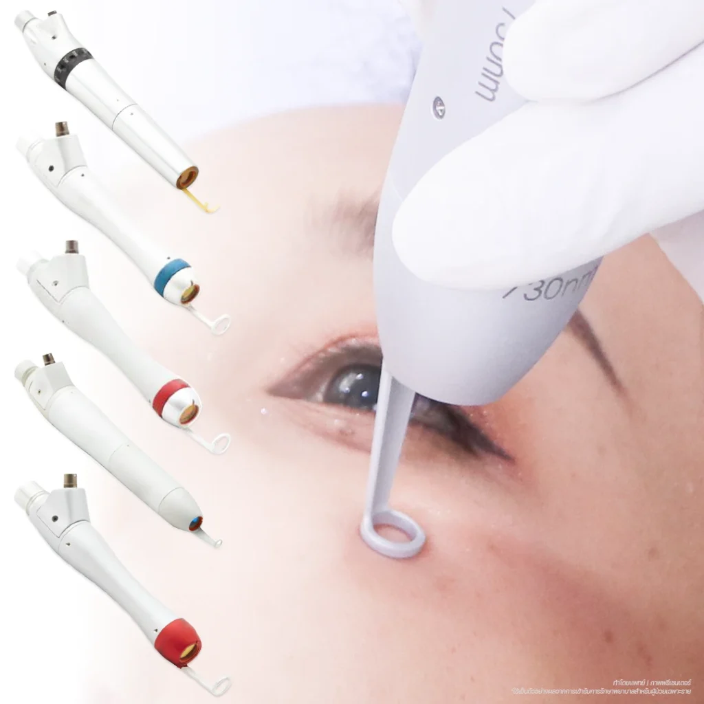ฝ้า กระ-Picoway Laser