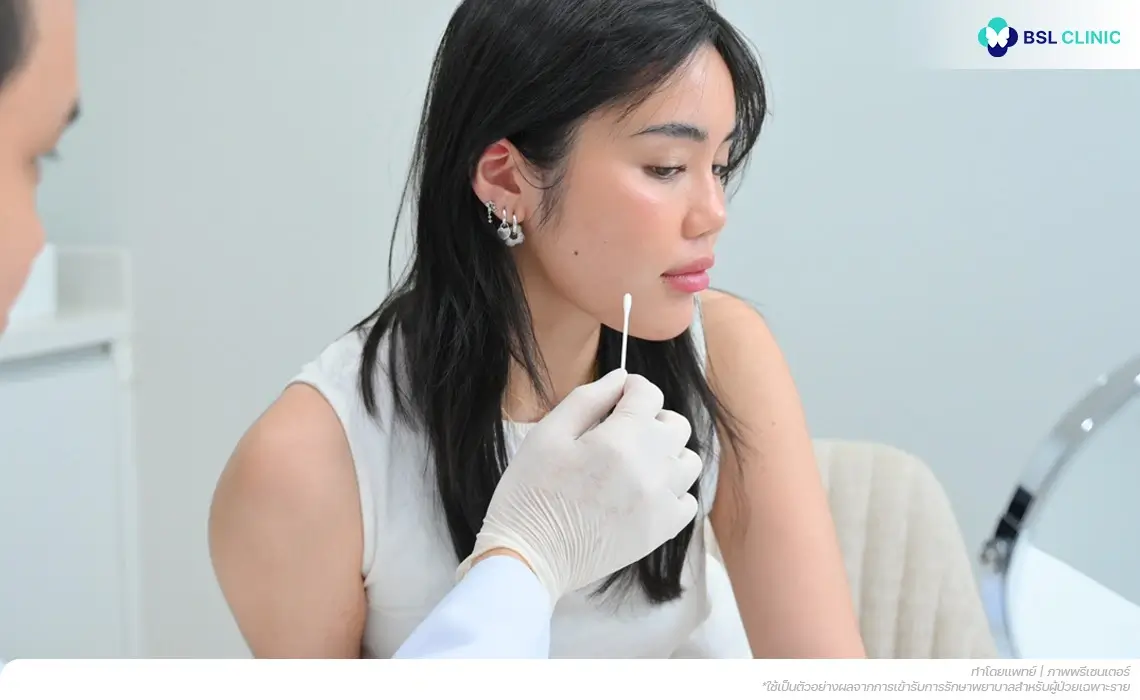 เลือกใช้ยารักษาสิว Suitable Acne Medicine