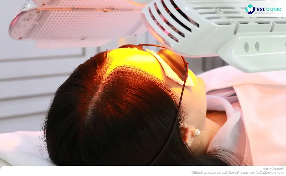 โปรแกรมฉายแสง Light Therapy Program