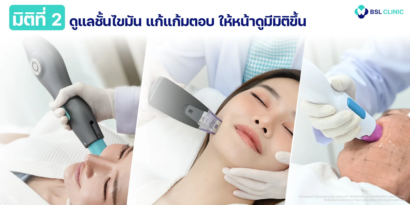 มิติที่ 2 ชั้นไขมัน แก้แก้มตอบ ให้หน้าดูมีมิติขึ้น