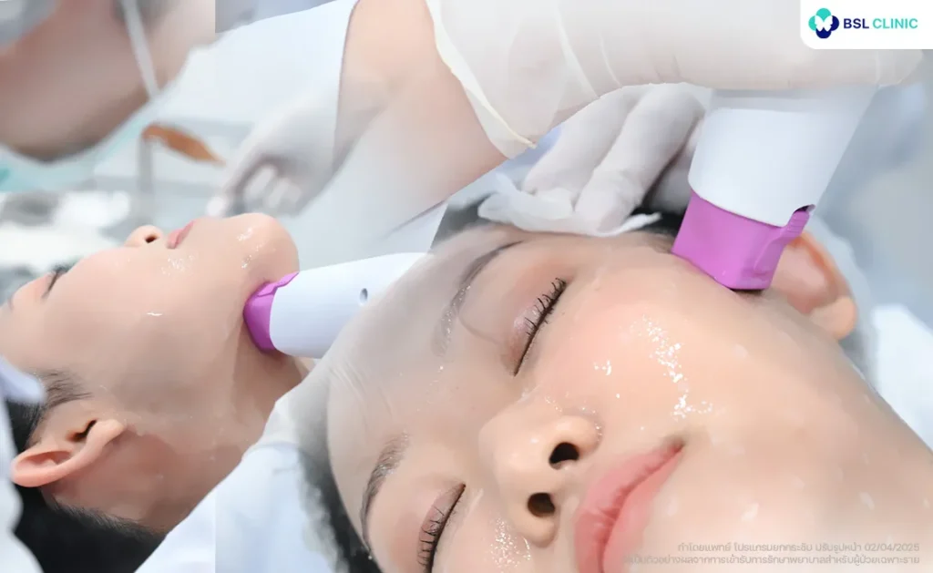 Thermage FLX Program ยกกระชับกรอบหน้า คุณหยก