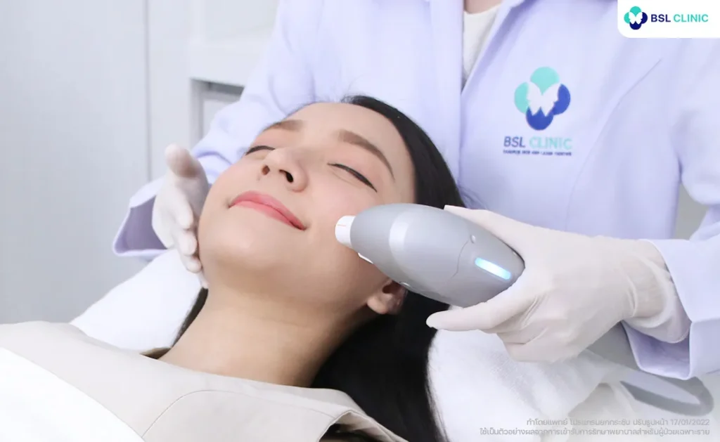 Ultralift คุณแตงโม