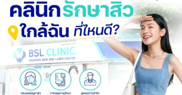 คลินิกรักษาสิวใกล้ฉัน