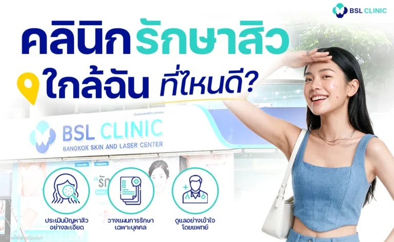 คลินิกรักษาสิวใกล้ฉัน