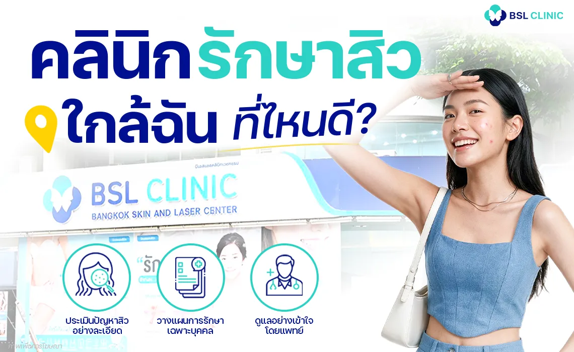 คลินิกรักษาสิวใกล้ฉัน