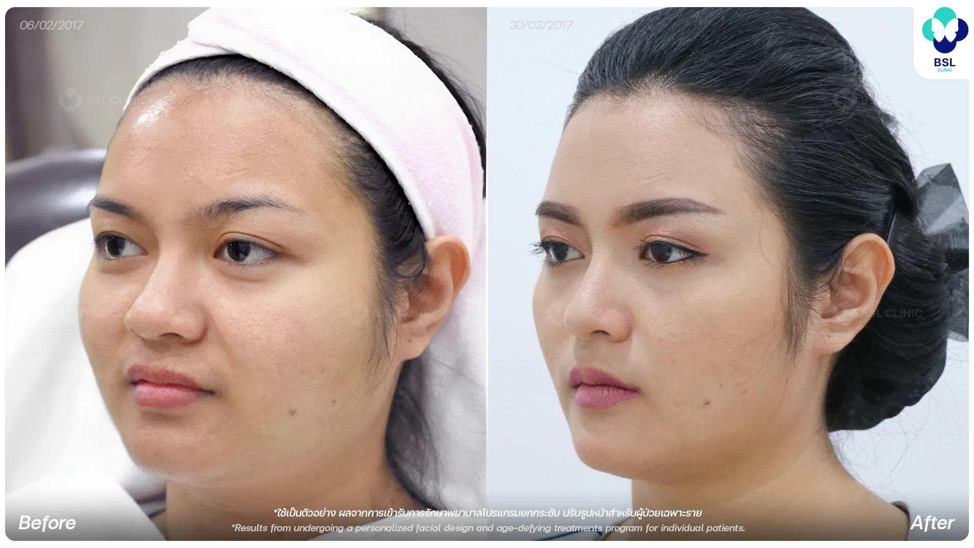ปรับรูปหน้า-01