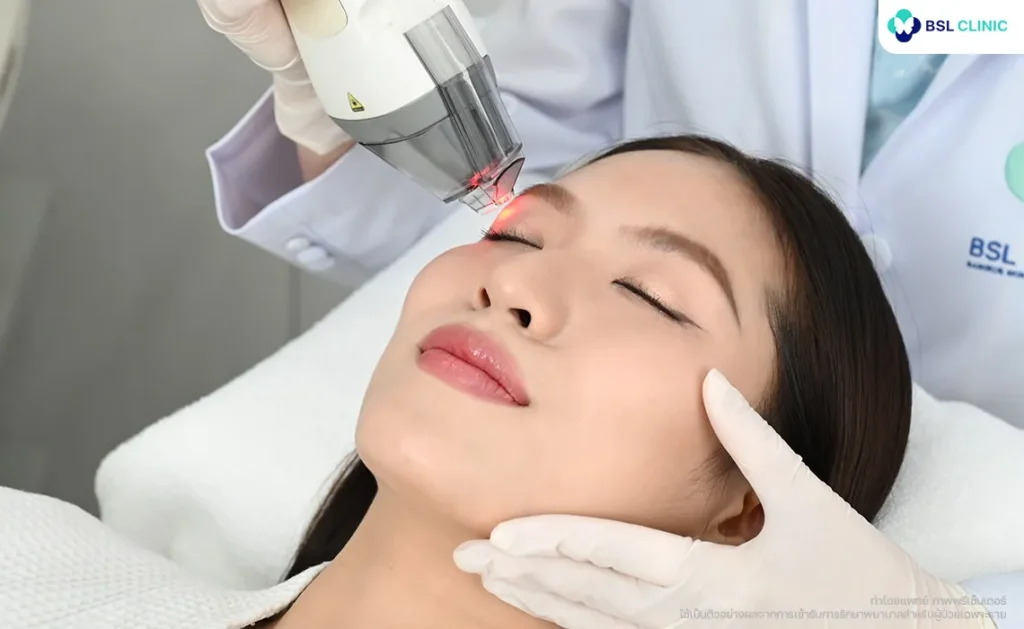 Fraxel Laser