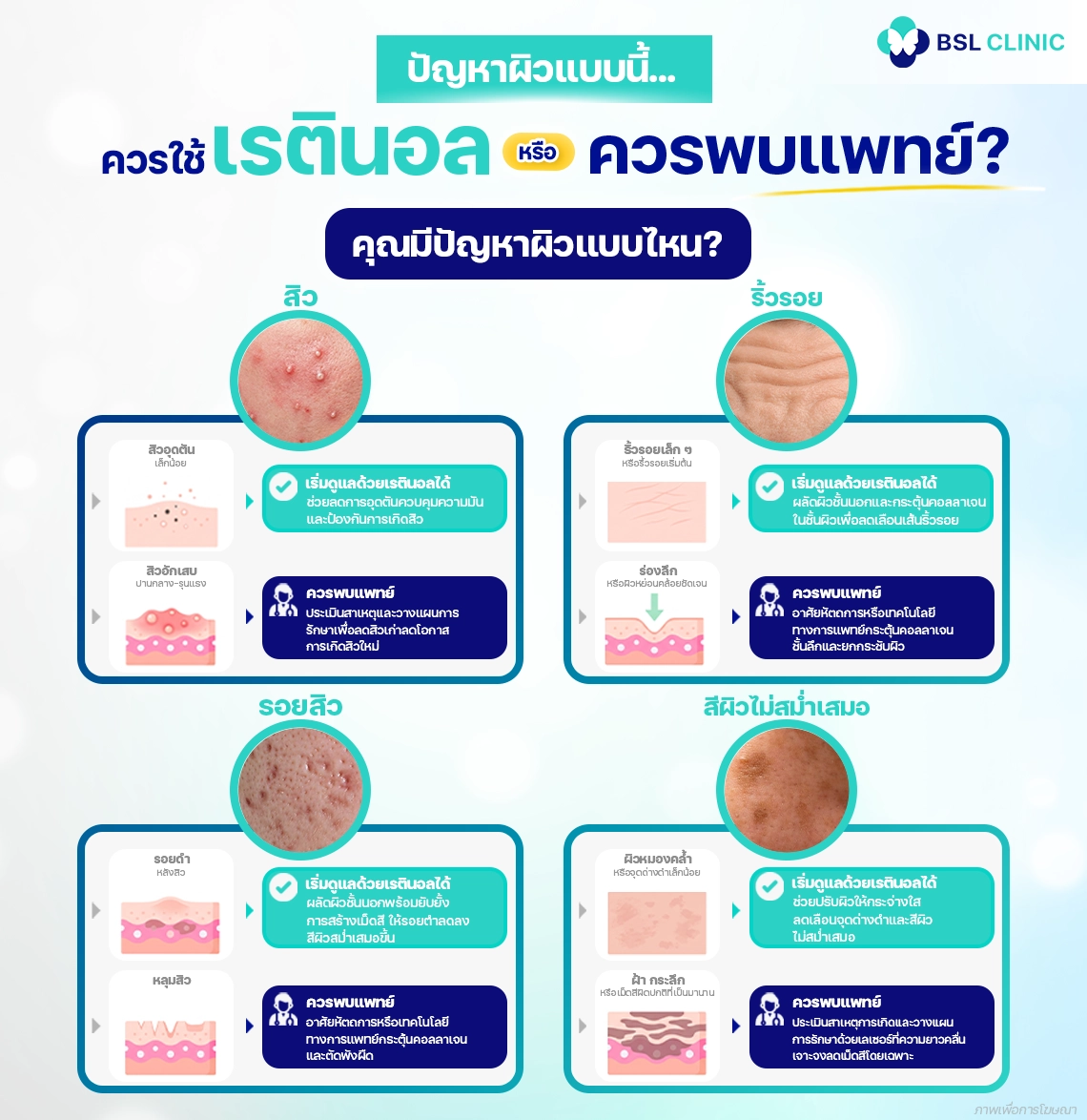 retinol or see doctor ใช้เรตินอลดีไหมแก้