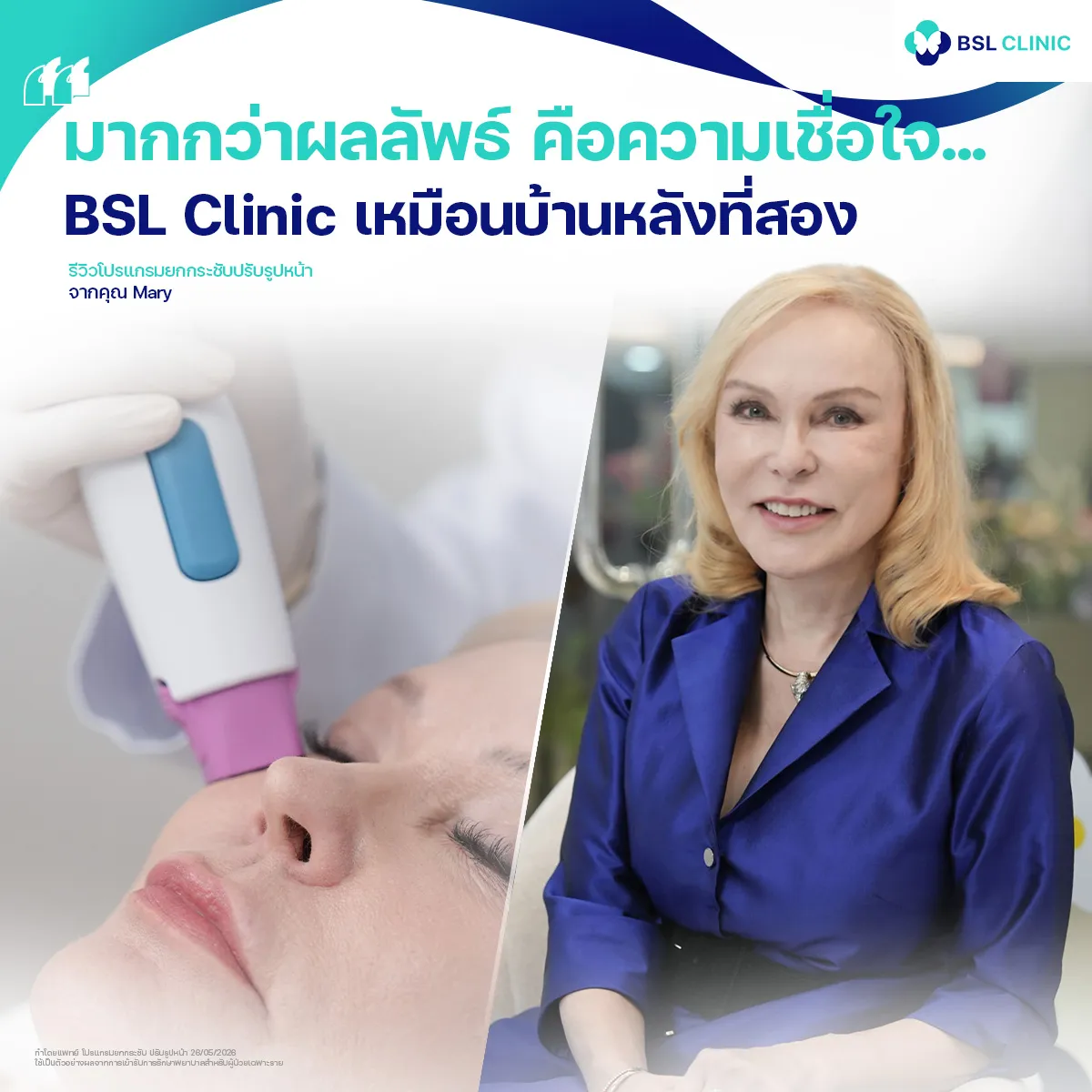 รีวิวหน้ายกกระชับจากผู้ใช้บริการจริง
