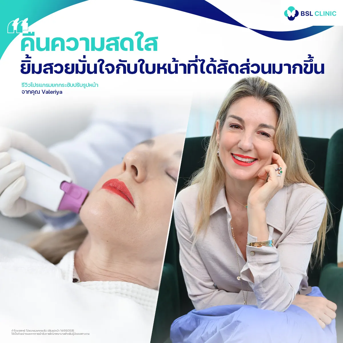 รีวิวหน้ายกกระชับจากผู้ใช้บริการจริง