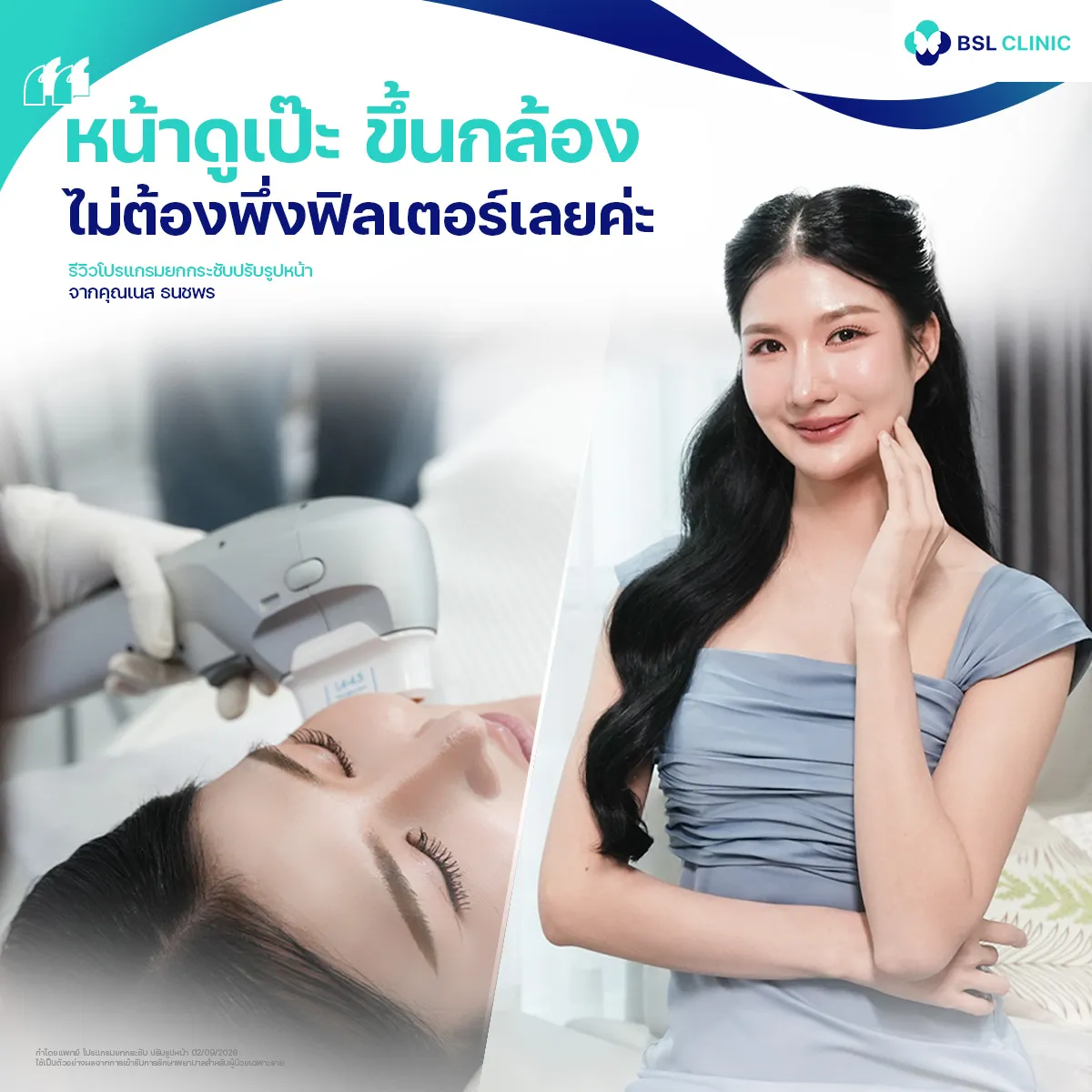 รีวิวหน้ายกกระชับจากผู้ใช้บริการจริง