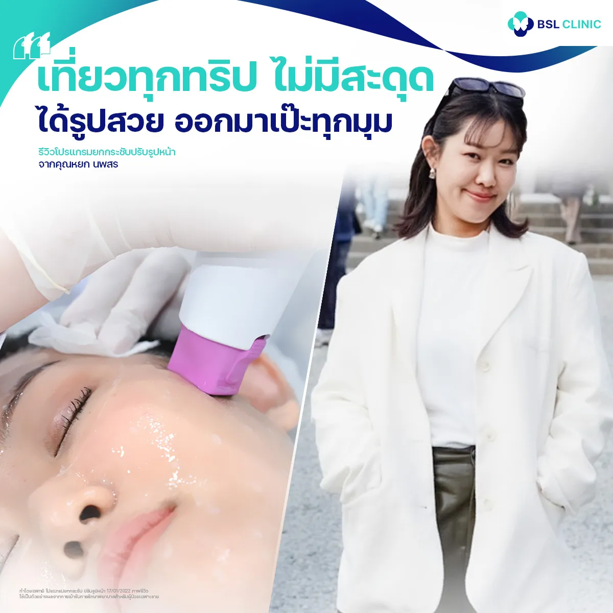 รีวิวหน้ายกกระชับจากผู้ใช้บริการจริง