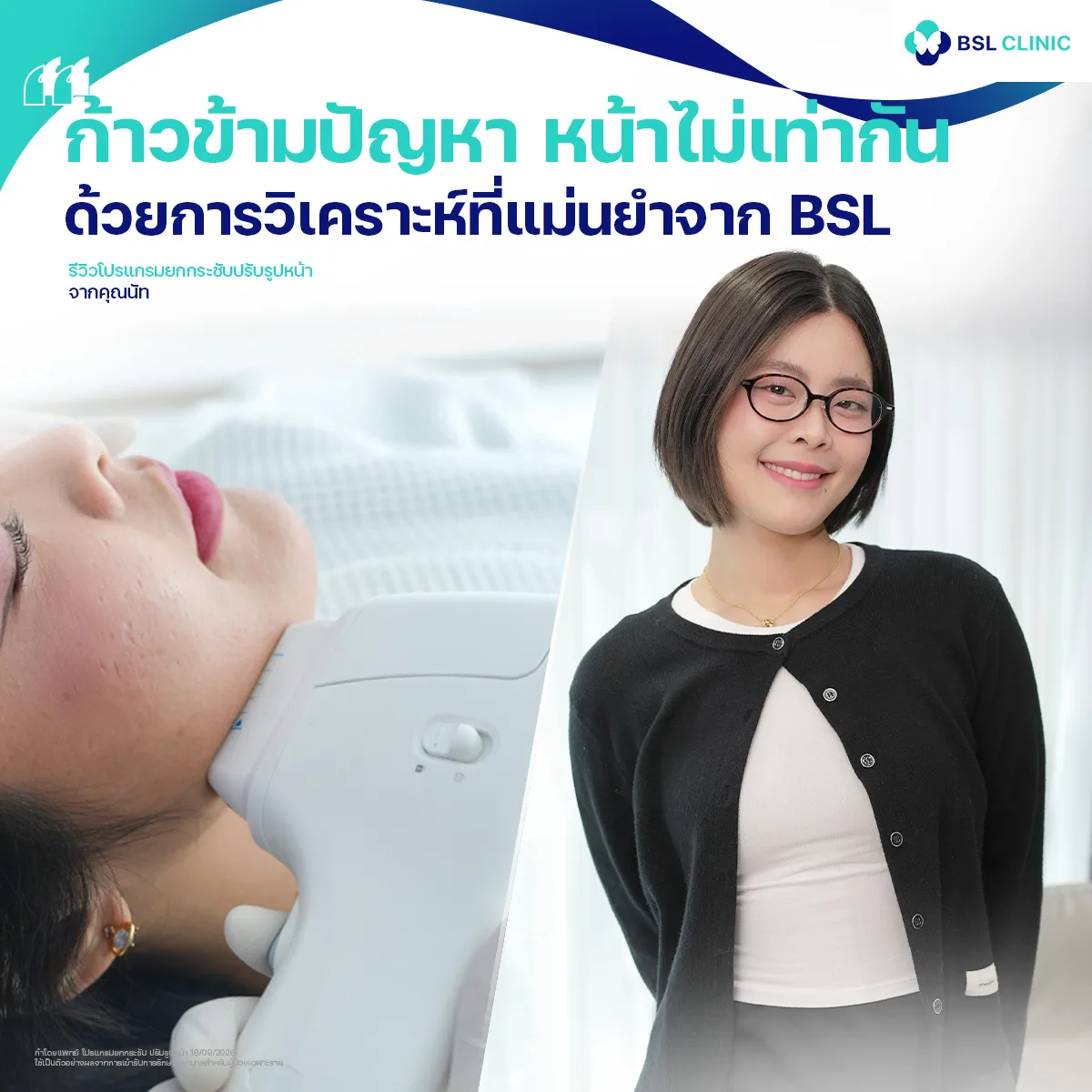 รีวิวหน้ายกกระชับจากผู้ใช้บริการจริง