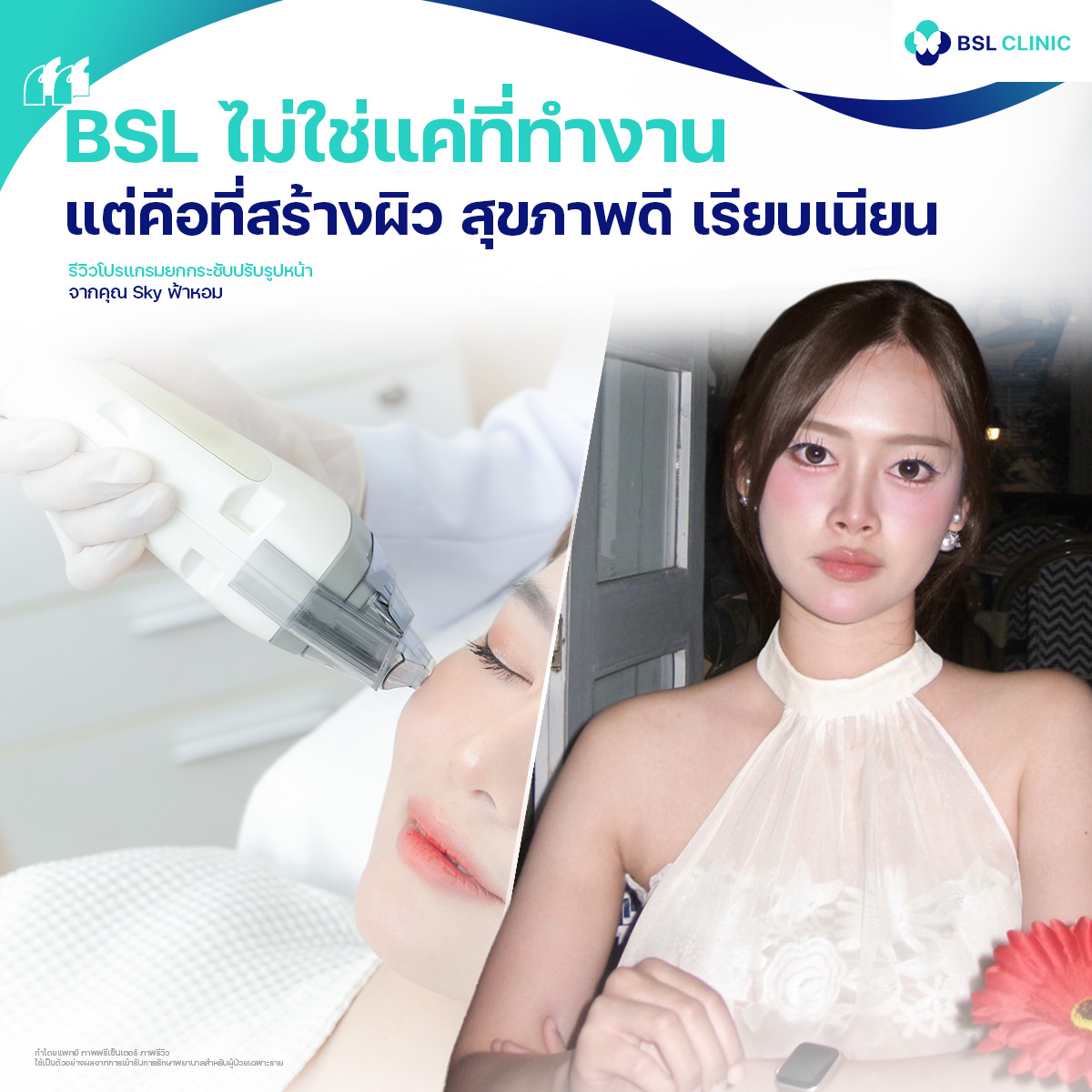 รีวิวหน้ายกกระชับจากผู้ใช้บริการจริง
