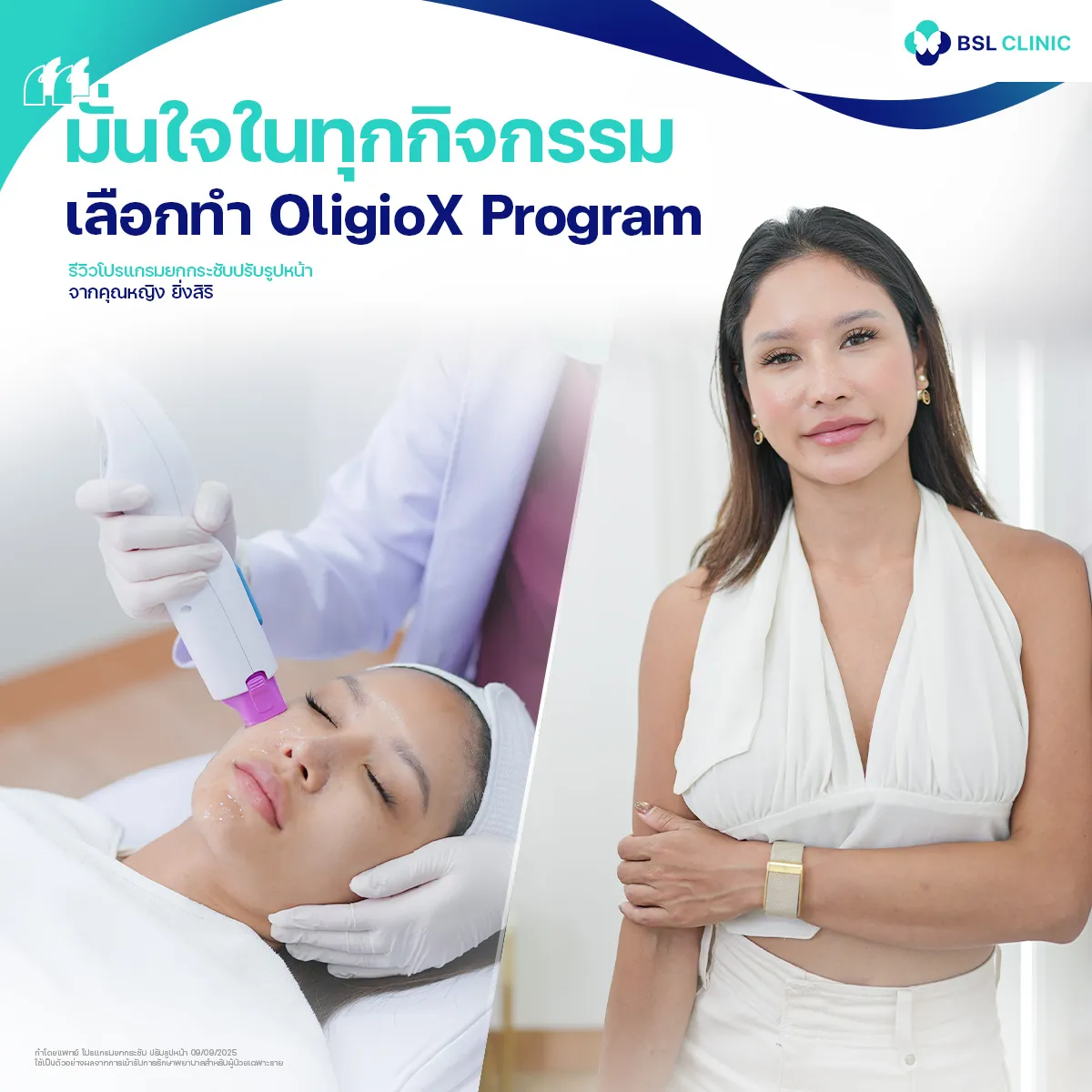 รีวิวหน้ายกกระชับจากผู้ใช้บริการจริง