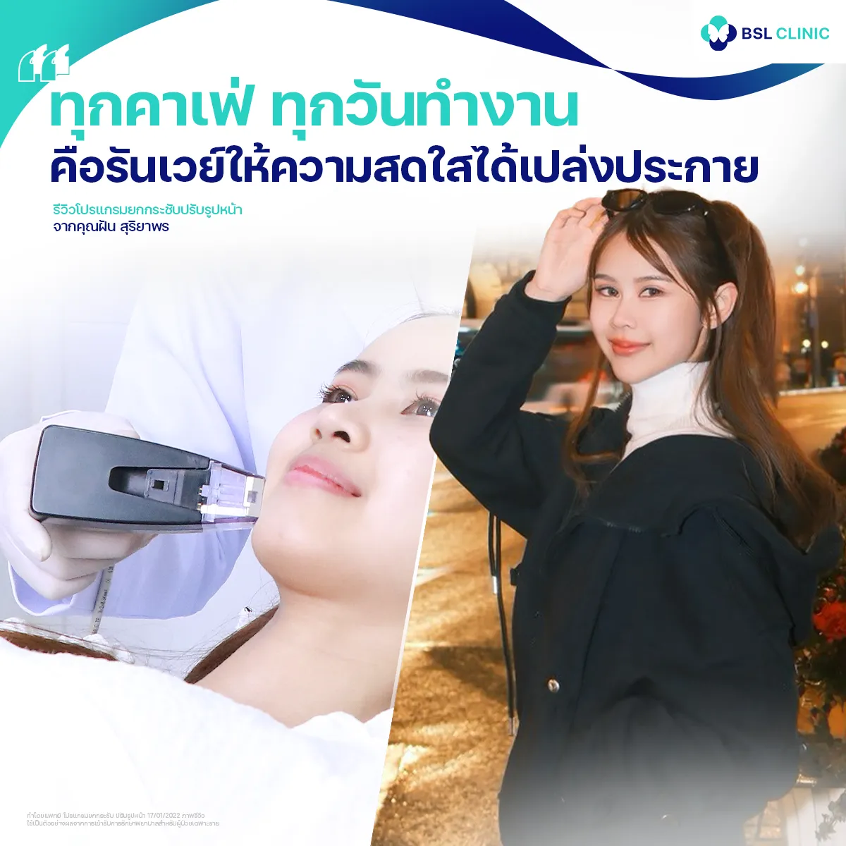 รีวิวหน้ายกกระชับจากผู้ใช้บริการจริง