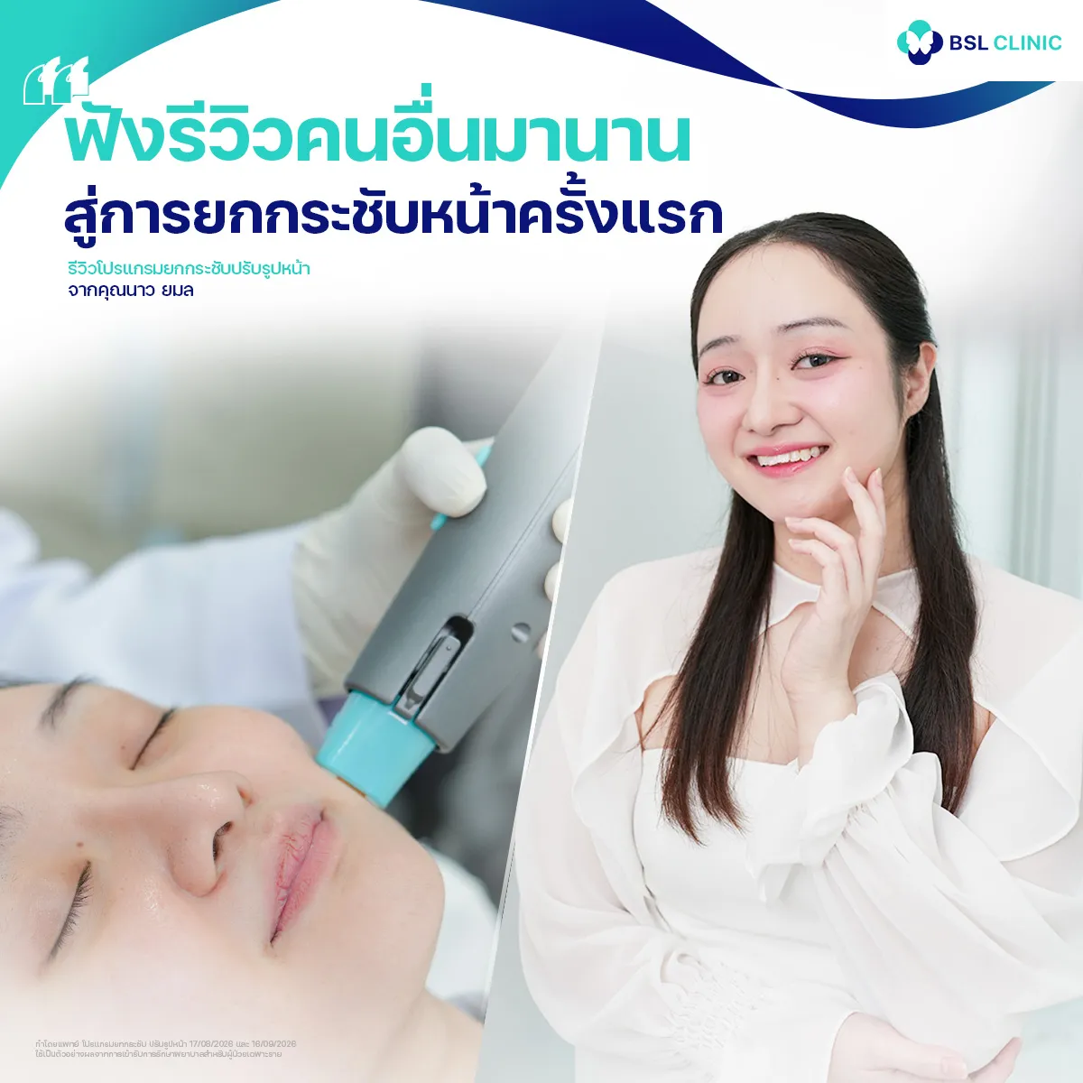 รีวิวหน้ายกกระชับจากผู้ใช้บริการจริง