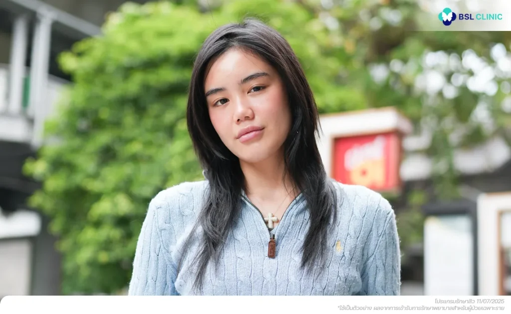 ผู้รับบริการจริงแบ่งปันประสบการณ์หลังรักษาสิวอุดตันและสิวอักเสบที่ BSL Clinic