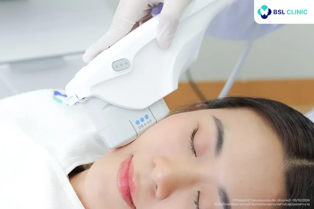 โปรแกรม Ultherapy PRIME