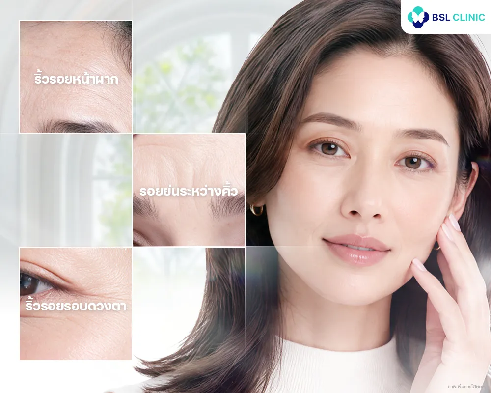 ลดริ้วรอยบนใบหน้า