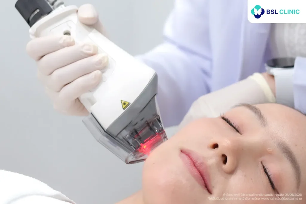 โปรแกรม Fraxel Dual Laser