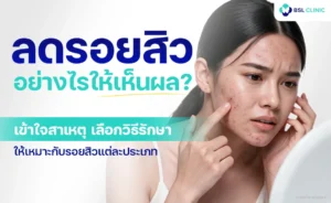how-to-reduce-acne-marks