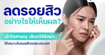 how-to-reduce-acne-marks