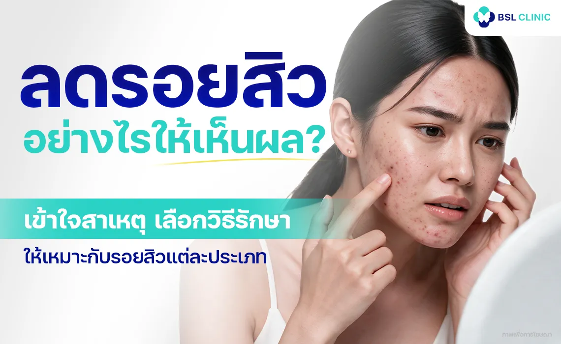 how-to-reduce-acne-marks