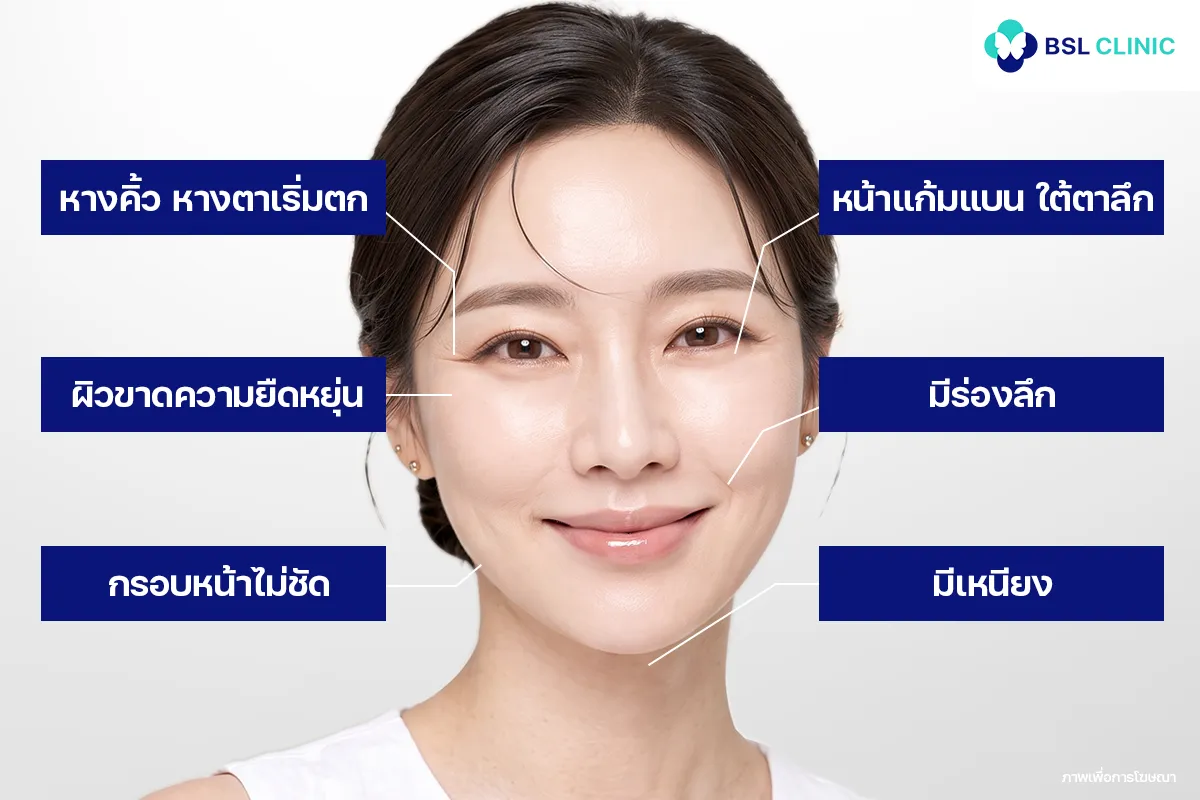 สัญญาณได้เวลายกกระชับหน้า
