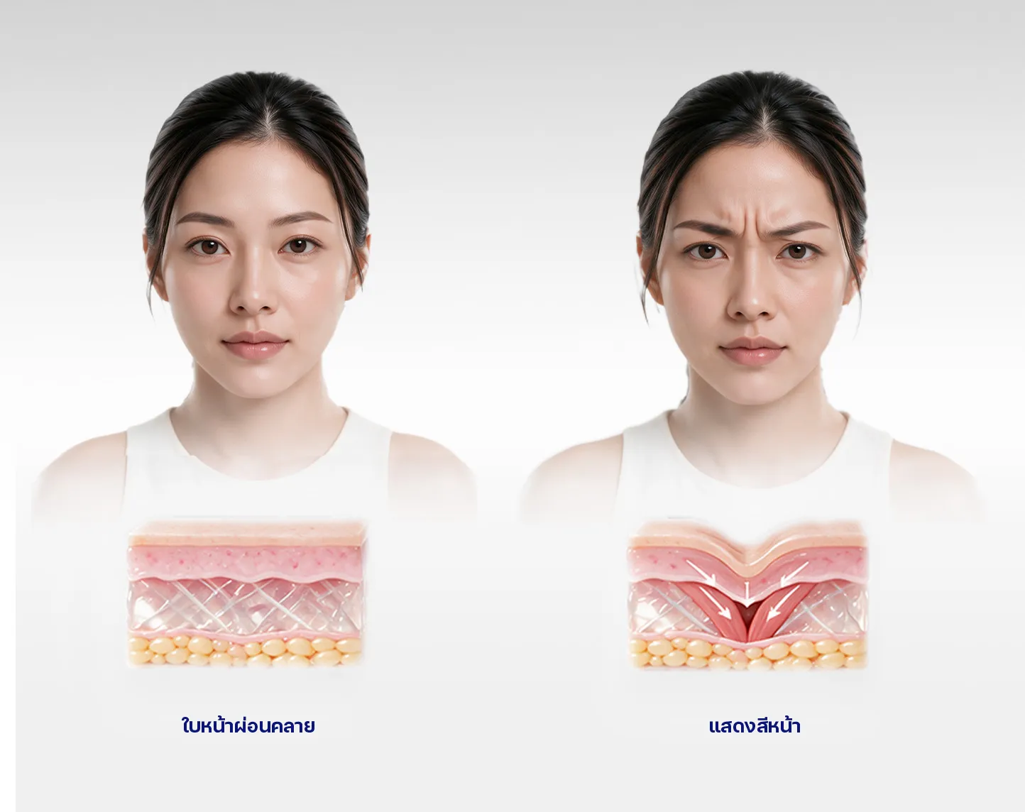 ริ้วรอยเกิดจากอะไร