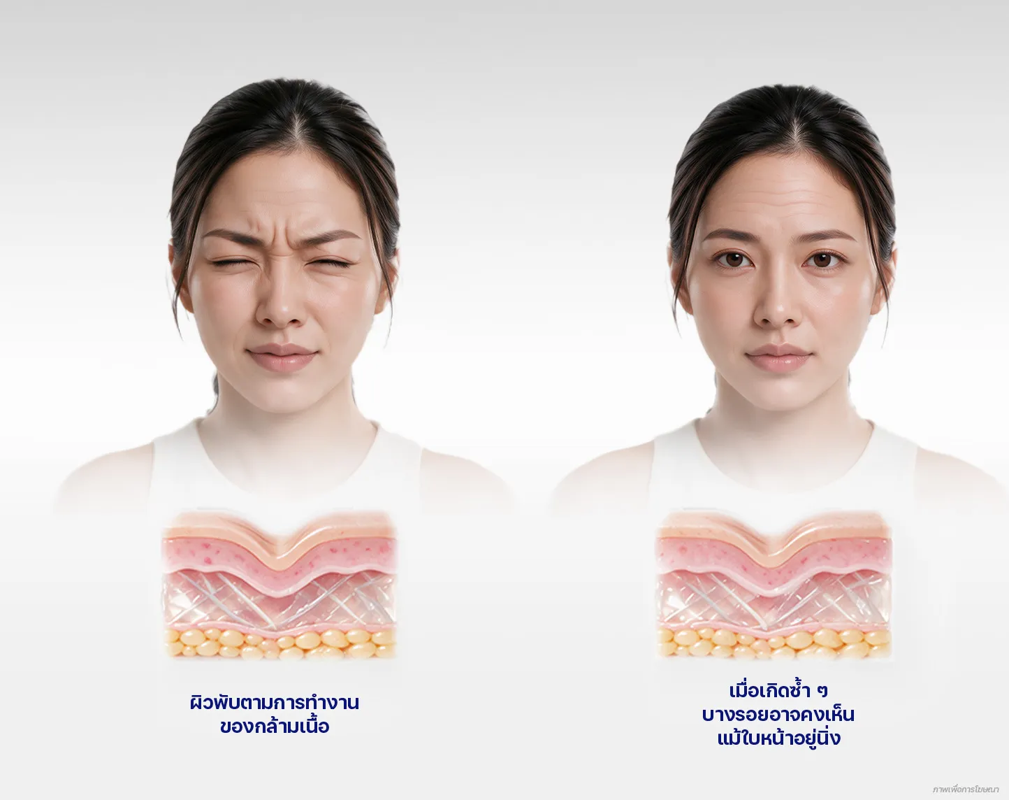 ริ้วรอยเกิดจากอะไร