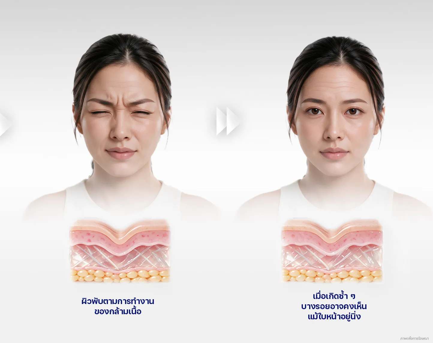 ริ้วรอยเกิดจากอะไร
