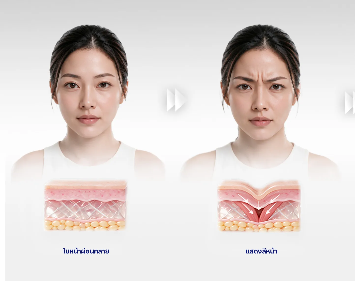 ริ้วรอยเกิดจากอะไร