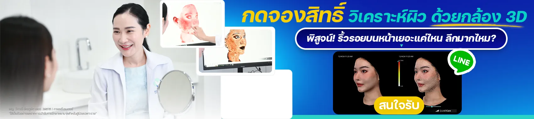 กดจองสิทธิ์ วิเคราะห์ผิว ด้วยกล้อง 3D