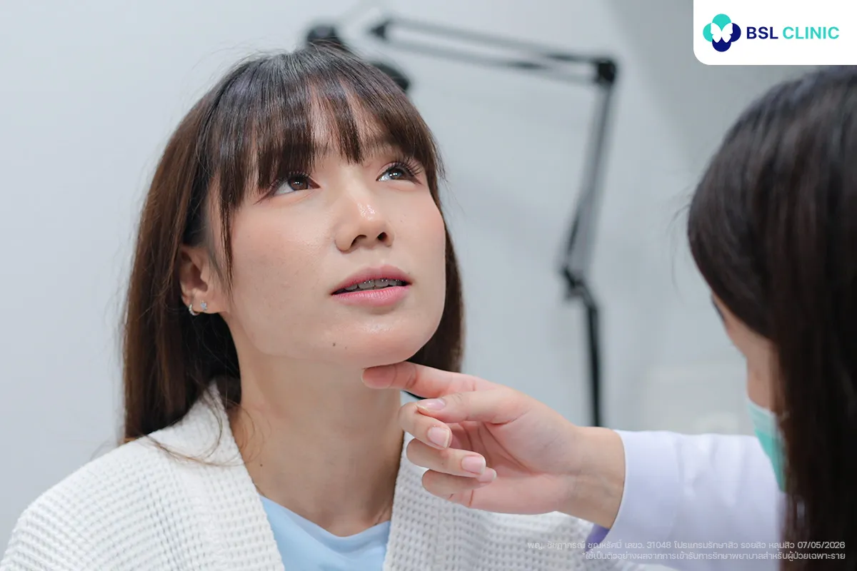 ประเมินชนิดของรอยสิวและสภาพผิวโดยรวมรักษารอยสิวที่ BSL clinic