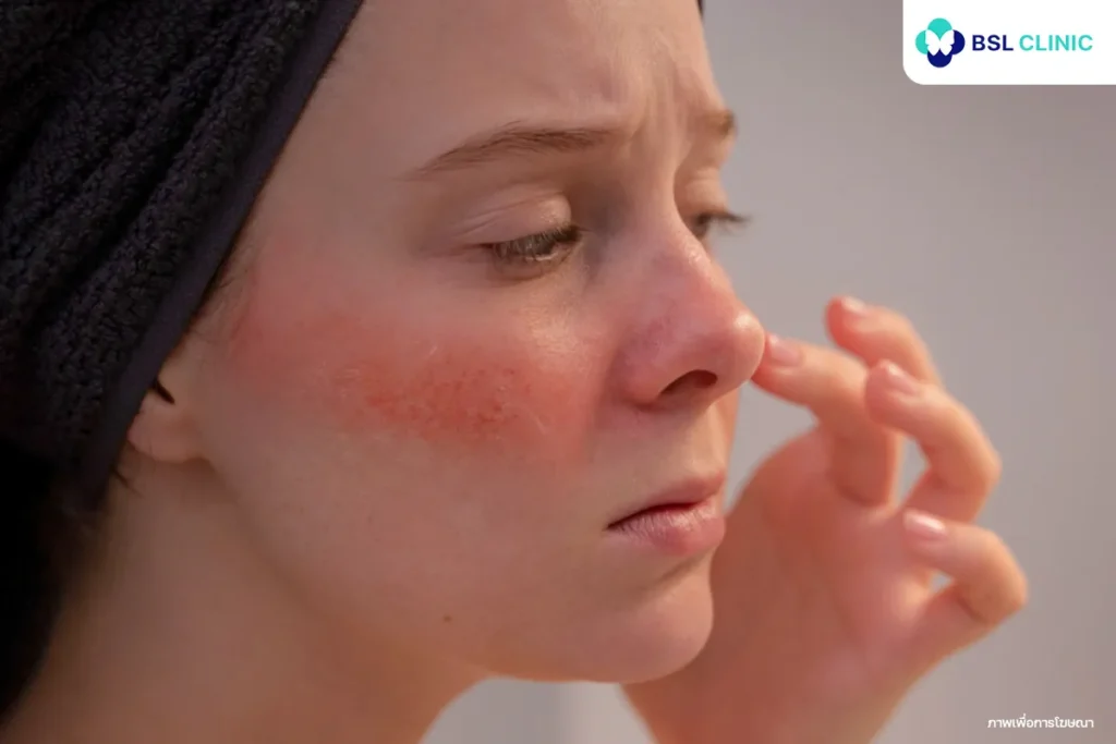 แพ้ Niacinamide อาการเป็นแบบไหน? ทำอย่างไรดี?